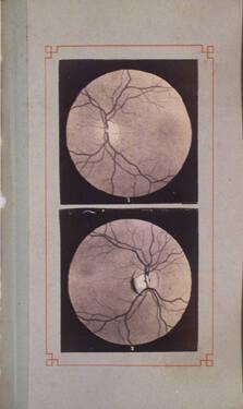 Ophthalmoscopy Clinic (Opthalmoscopie Clinique)