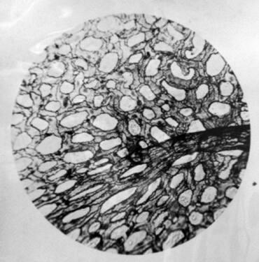 Small Artery and Capillaries from Lung of Frog