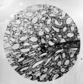 Small Artery and Capillaries from Lung of Frog