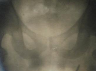 X-Ray