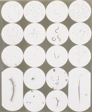 Pathogenic Microorganisms, Plate II (Pathogen Mikroorganismen)